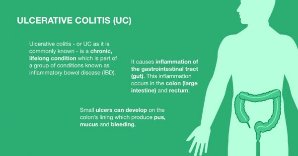 How Cannabis Can Treat Ulcerative Colitis (UC) | Canuvo